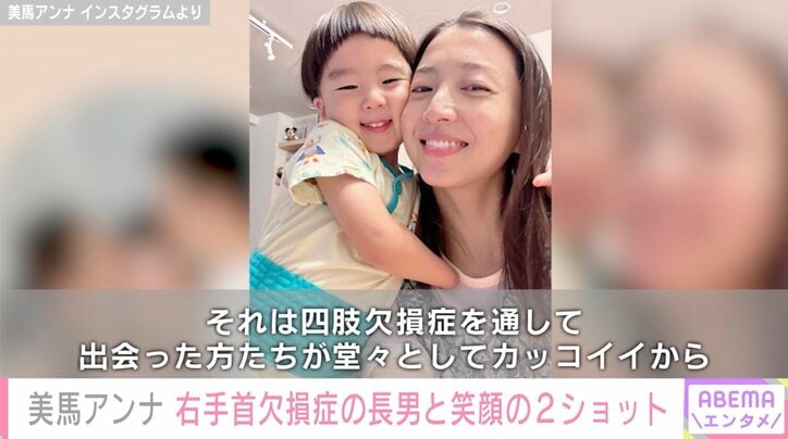 ロッテ・美馬学投手の妻アンナ、先天性右手首欠損症の長男への思いを語る「堂々と生きてほしい」