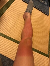 横山だいすけ『タイ…いタイ…』