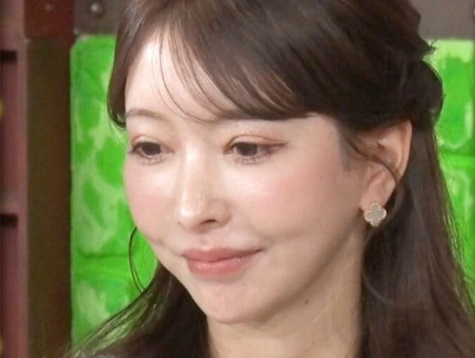 【写真・画像】「双子の娘が共に整形」実母が本音を告白「最初は大反対」「元々私に似て可愛かったのに…」　1枚目