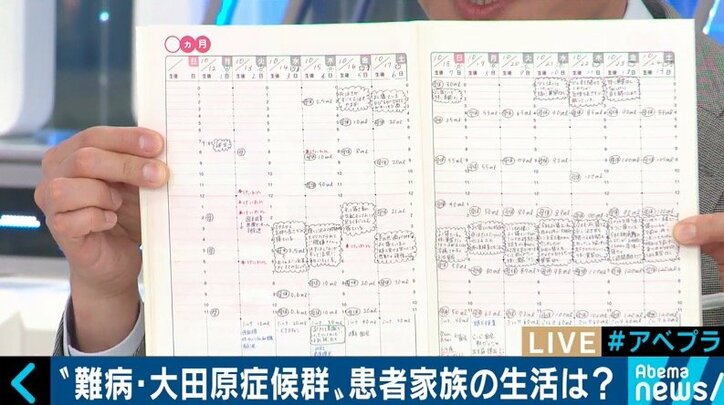 日本に100人未満…希少難病「大田原症候群」患者母子に密着