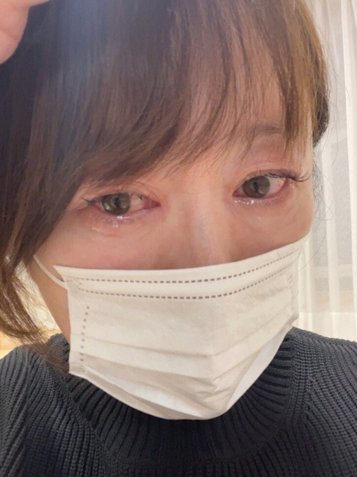  元おニャン子・内海和子、目が“最悪の状況”になり急いで眼科へ「急に炎症が起きて驚きました」 