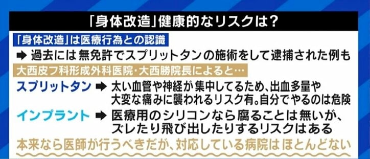 「デンタルフロスの糸で毎日、強めに舌を…」自らスプリットタンにも挑戦した男性に聞く“身体改造”