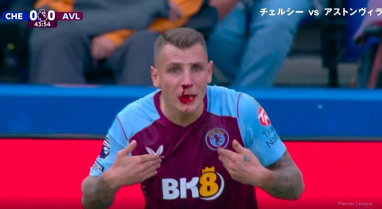 大流血！鼻血垂れ流しで審判にブチギレ猛抗議「肘打ち喰らったのにファウルかよ！」興奮してさらに血が止まらない衝撃映像