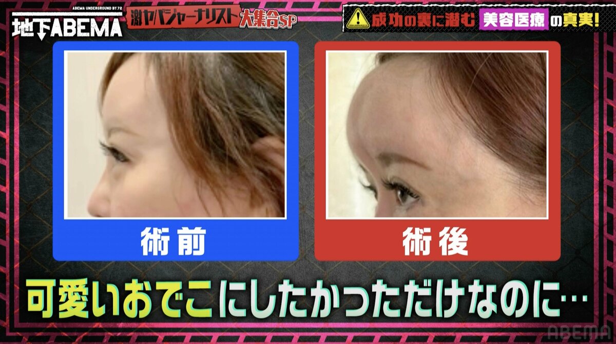 整形 失敗 画像