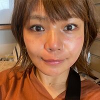 クロ『”妻の整形、夫はどう感じてるの？”』