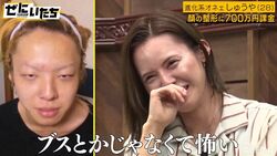 整形に700万課金、衝撃のビフォーアフター写真にかまいたち濱家「俺もああなれんのか」