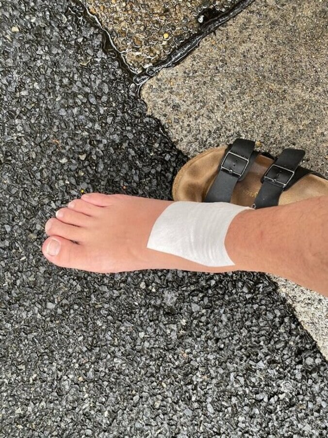 エハラマサヒロ、痛風が長引いていることを報告「凄く心配」「無理しないで」の声 1枚目