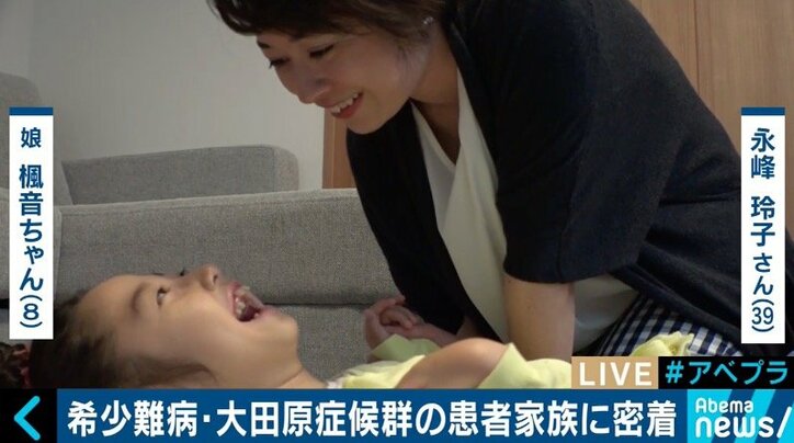 日本に100人未満…希少難病「大田原症候群」患者母子に密着