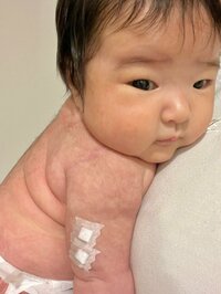 内山琴『予防接種打ってきたよ〜！』