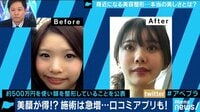 AbemaPrime【平日よる9時～生放送】 - 企画 - ヒトの評価は顔で決まる? 件数は韓国超で身近になる美容整形 (19/04/11) | 動画視聴は【Abemaビデオ(AbemaTV)】