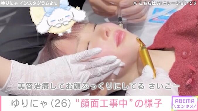 【写真・画像】3歳児ほどのウエストが話題 ゆりにゃ、“顔面工事中”の様子を公開「痩せたらコケたコケたってうるさいから」　2枚目