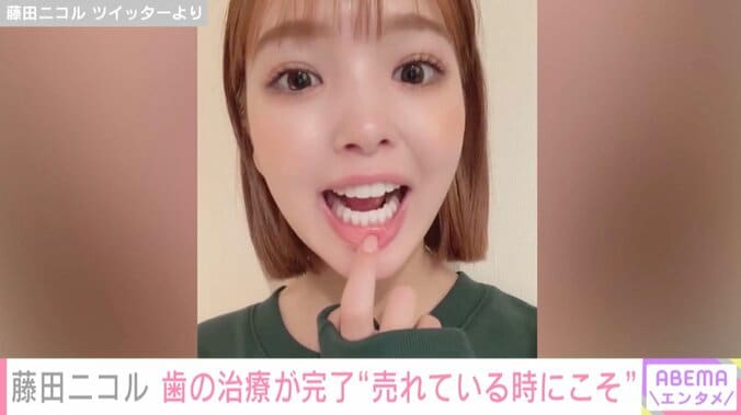 藤田ニコル、セラミックの前歯を短くし下の歯6本もセラミックに変えたことを報告「大満足です！」 1枚目