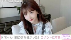 「普通にムカつく」整形総額約2000万円 Rちゃん「前の顔の方が好きだった」一部の声に反論