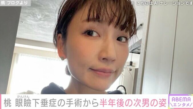 【写真・画像】桃（40）、左目の先天性眼瞼下垂症の手術から半年経った3歳次男の姿を公開　1枚目
