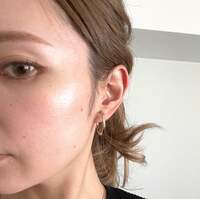 佐々木かい『シミ取りに行ってきました の巻』