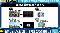 少しずつ奪われる視力、視野…“見えることが前提の社会”で悩む5万人の網膜色素変性症患者たち