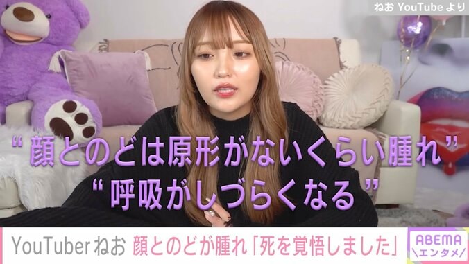 「死を覚悟しました」YouTuberねお、マカロンで“アナフィラキシーショック”に 顔や耳など真っ赤に腫れた写真公開 1枚目