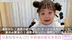 先天性疾患による低身長・りおなちゃん（7）、手術後の3つの変化を報告「ホッとしています」「表情がとても明るい！」とファンも喜び