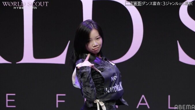 痛々しいほど巨大なアザに指原が衝撃「あそこまでのアザはない」