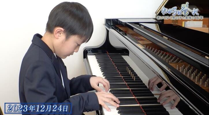 【写真・画像】5倍の速さで老化が進む「コケイン症候群」を抱える男の子 余命１年…家族の決断は 「わが子は誉れ」懸命に生きた16年の記録　12枚目