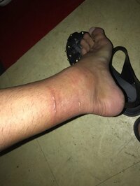 HighsidE（山田親太朗）『ハブクラゲ』