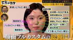 22歳セクシー女優、顔面フル整形を決意！見積もり総額にかまいたち絶句