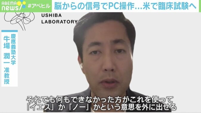 脳の信号でPC操作 米の臨床実験に専門家「ゼロが1になる」「ALS患者にとって大きな一歩だ」 4枚目