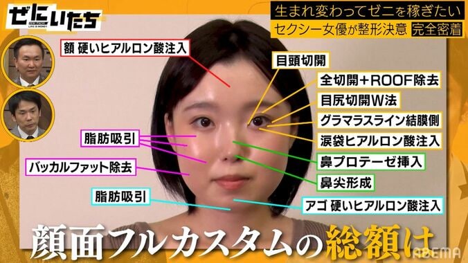 22歳セクシー女優、顔面フル整形を決意！見積もり総額にかまいたち絶句 5枚目