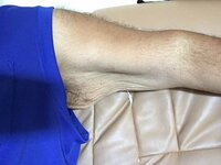 安田大サーカスHIRO『皮がヤバイ！！_:(´ཀ」 ∠):』