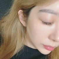 日菜あこ『美容整形で4万円のコースを契約』