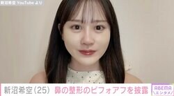2024年に「つばきファクトリー」を卒業・新沼希空（25）、鼻の整形のビフォアフを披露「ずっと鼻がコンプレックス」