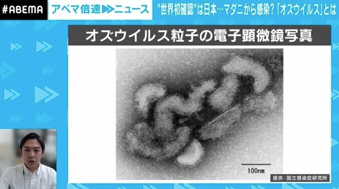 ペットと“濃厚接触”する人はキケン？ 茨城でマダニに噛まれた女性死亡━━噛まれても気づきにくい“サイレントキラー”の対策は 1枚目