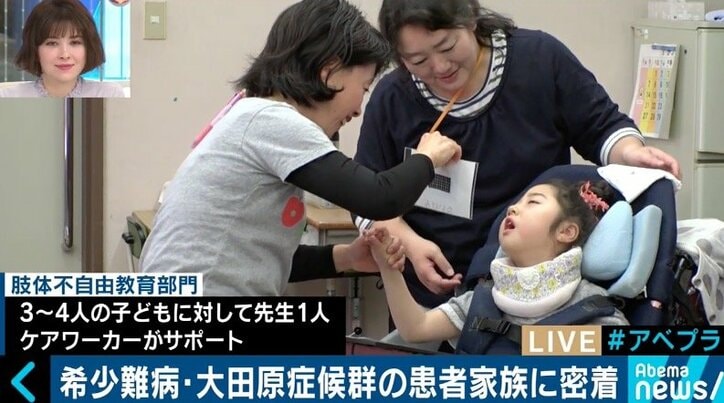 日本に100人未満…希少難病「大田原症候群」患者母子に密着