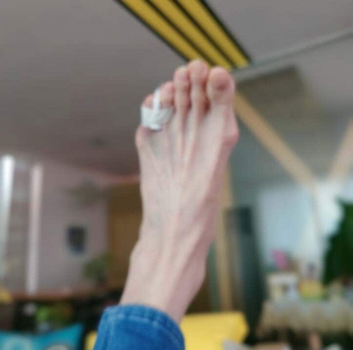 【写真・画像】「ドジな私です」秋野暢子、足の小指を骨折した姿を披露し「痛々しいです」「お大事に！」と心配の声　1枚目