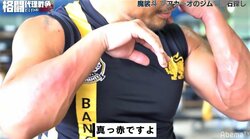 【画像】魔裟斗、両腕“内出血”にファン「エグい」