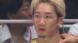 【画像】因縁の対決は衝撃の1ラウンド衝撃決着（複数）