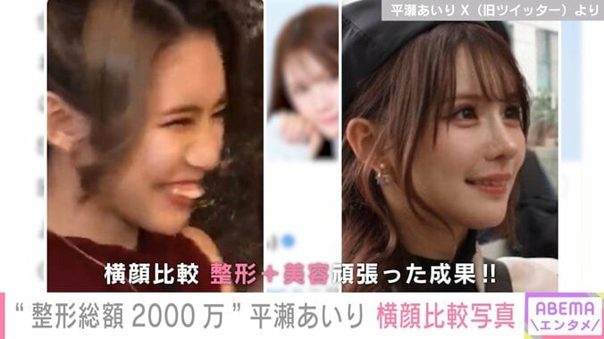 “整形総額2000万” グラドル・平瀬あいり、無加工の “横顔比較ショット” を披露「ものすごく大変だったけど頑張ってよかった」 1枚目