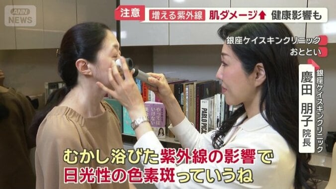 むかし浴びた紫外線の影響で…