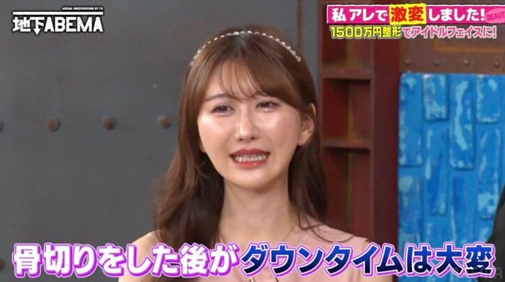 【写真・画像】「まだやりたい」“総額1500万円”整形をくり返す美女に香取慎吾が驚き「もういいよ」 2枚目