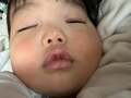  あいのり・桃、眼瞼下垂の手術を受けた次男が寝ている時の様子「閉じてないなぁ…」 