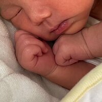 だいたひかる『術後1週間、傷の経過』