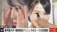 【映像】西野未姫、整形するなら…