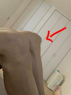  ネイボール、白血病と診断される前に自身に出ていた症状「身体を何処にもぶつけてもいないのに」 