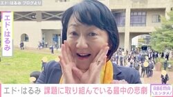 エド・はるみ、大学院の課題に取り組んでいる最中に悲劇「赤くなり皮膚もむけていました」