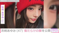 浜崎あゆみ（47）、ライブ後に見せた“腫れ上がった傷だらけ”の脚を公開 「痛々しい」「膝のアザがすごい」などの声