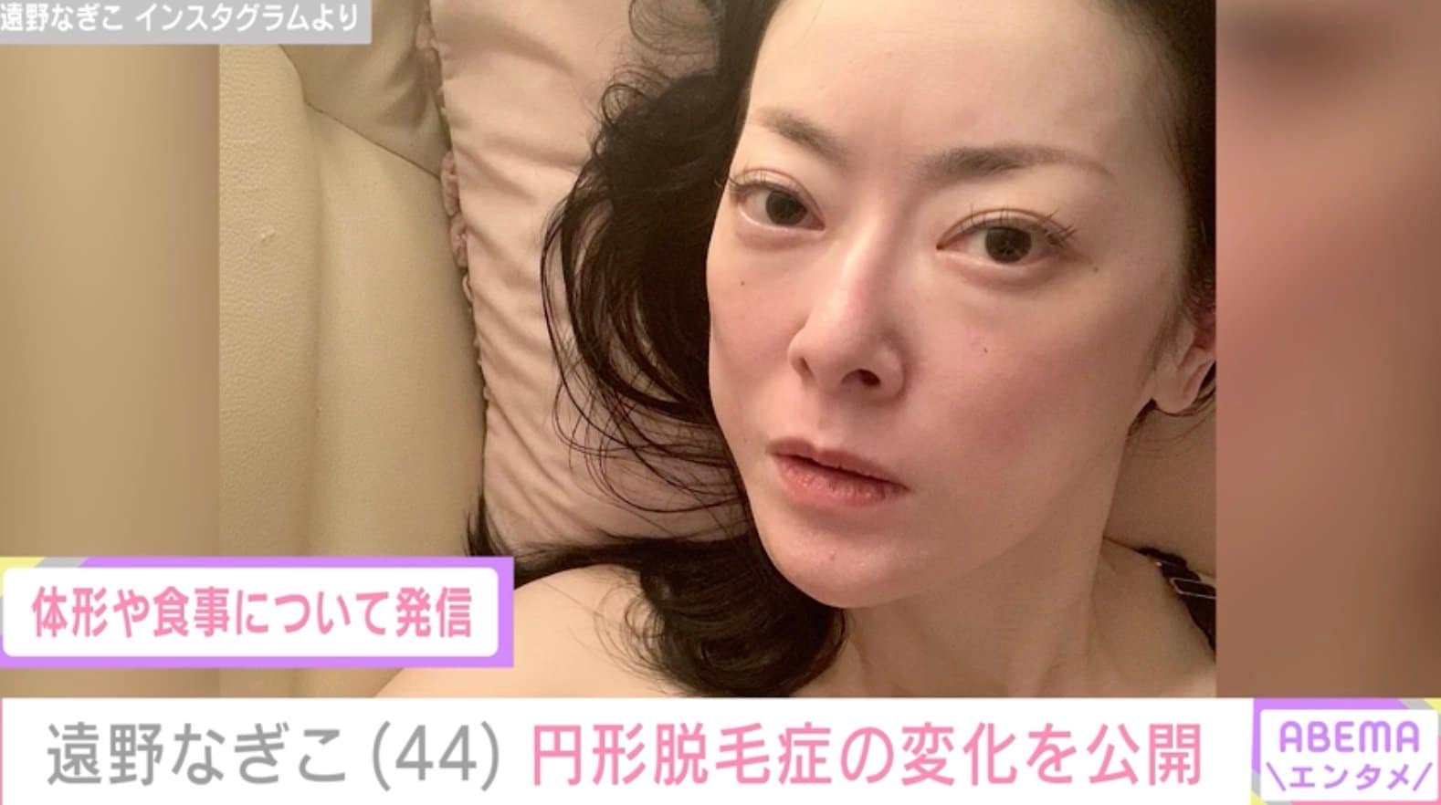 無毛症 摂食障害を公表・遠野なぎこ、円形脱毛症の変化を告白「グングン成長してない？」 | エンタメ総合 | ABEMA TIMES | アベマタイムズ