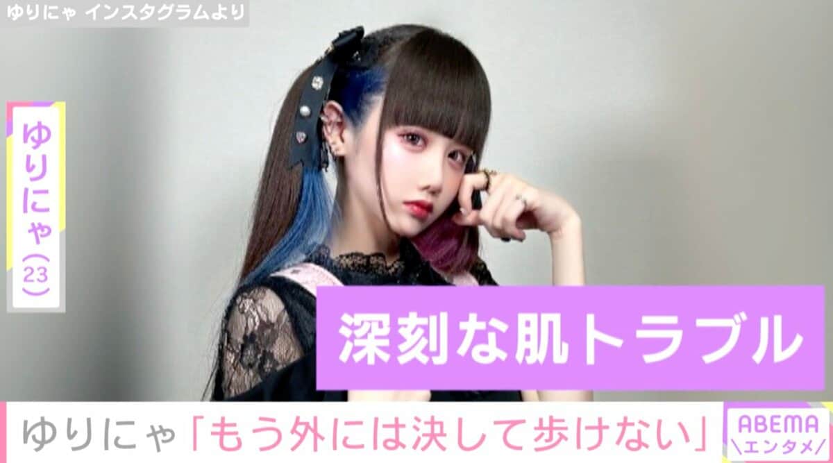 162cm＆39.5kgの人気TikTokerゆりにゃ「重症、もう外には決して、歩け