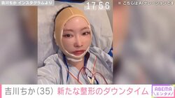 “姉妹の整形総額4000万円超”双子モデル・吉川ちか、新たに整形し「一番しんどかった」ダウンタイム中の様子を公開