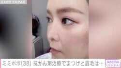 34歳で余命宣告を受けたミミポポ（38）、抗がん剤治療後のまつ毛と眉毛の変化を明かす