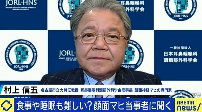 「自分の顔が自分の顔じゃなくなってしまう感じが残った」ジャスティン・ビーバーも罹患した“ラムゼイ・ハント症候群”、発症のピークは20代と50代に 6枚目